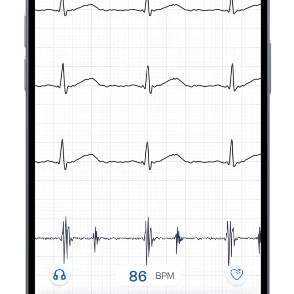 Eko CORE 500 Digital Stethoscope