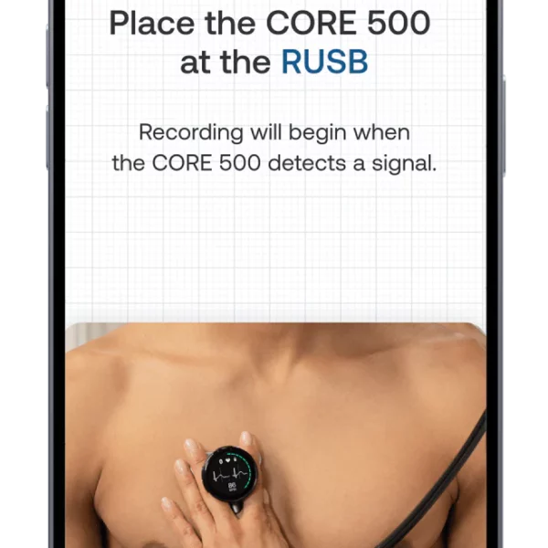 Eko CORE 500 Digital Stethoscope