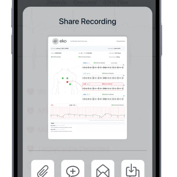 Eko CORE 500 Digital Stethoscope
